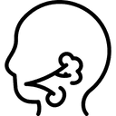 Bell's Palsy Treatment